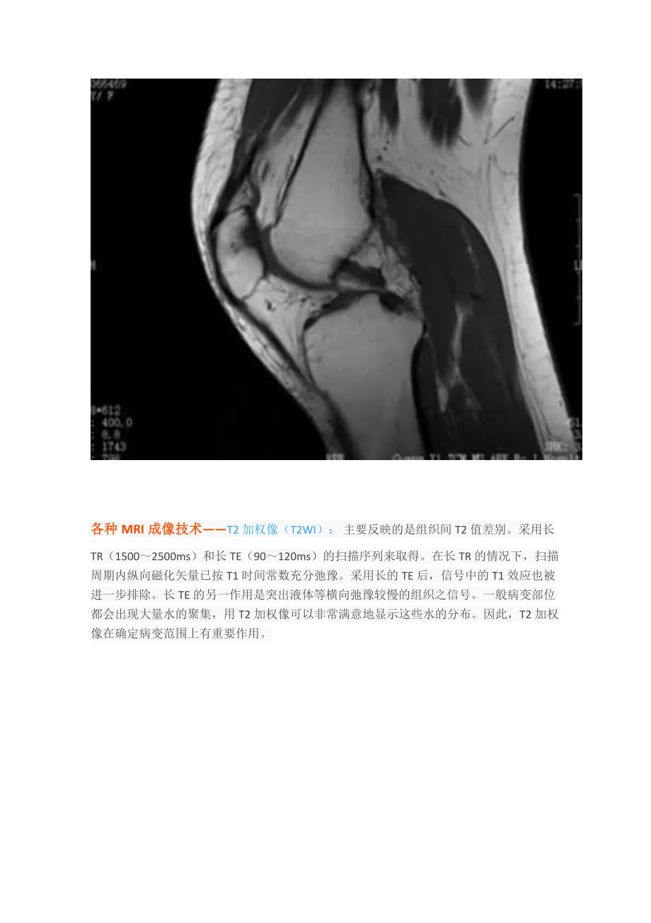 临床医生阅读mri技巧_第3页