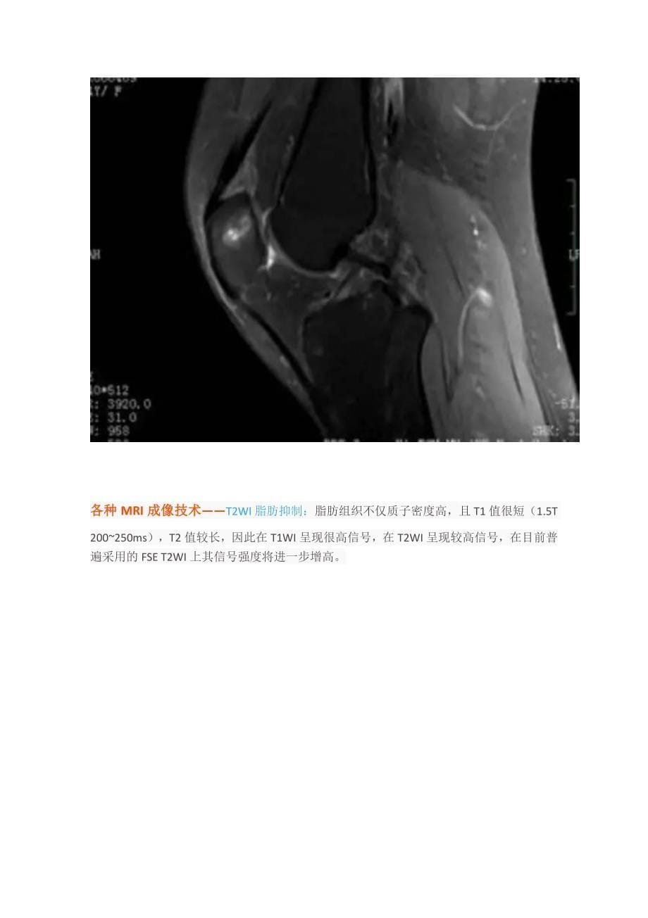 临床医生阅读mri技巧_第5页