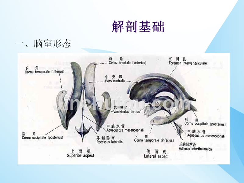 课件：侧脑室穿刺术_第2页