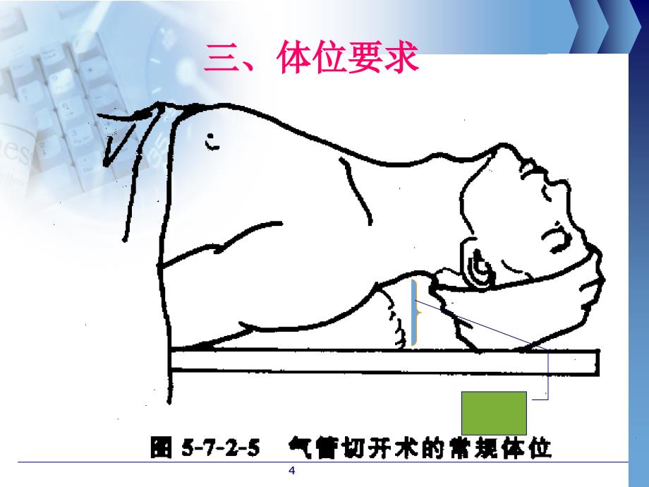 气管切开病人护理课件-(1)_第4页