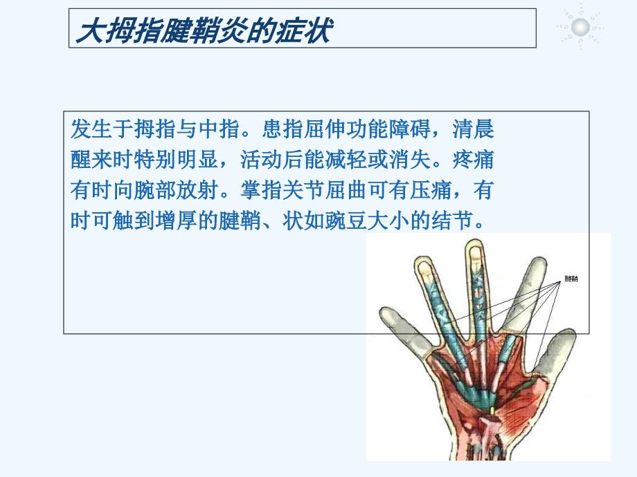 大拇指腱鞘炎症状表现_第3页