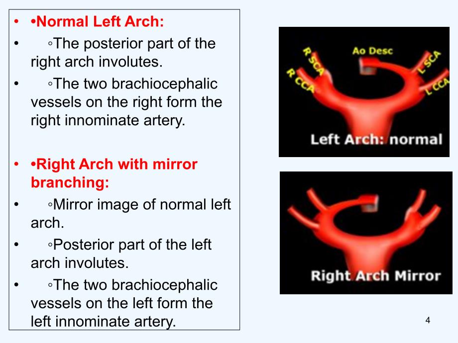 主动脉血管变异，肺动静脉英文课件_第4页