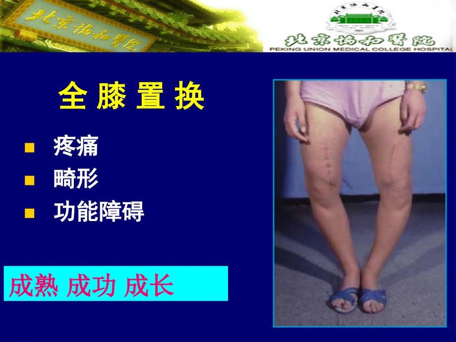 全膝置换下肢力线-2011广州终版_第2页