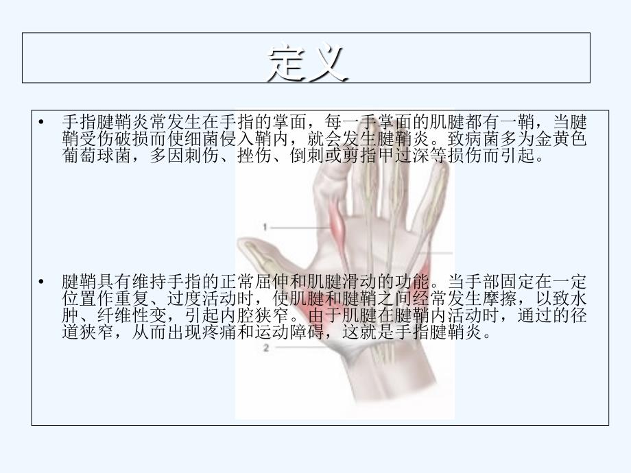 手指腱鞘炎症状与治疗_第3页