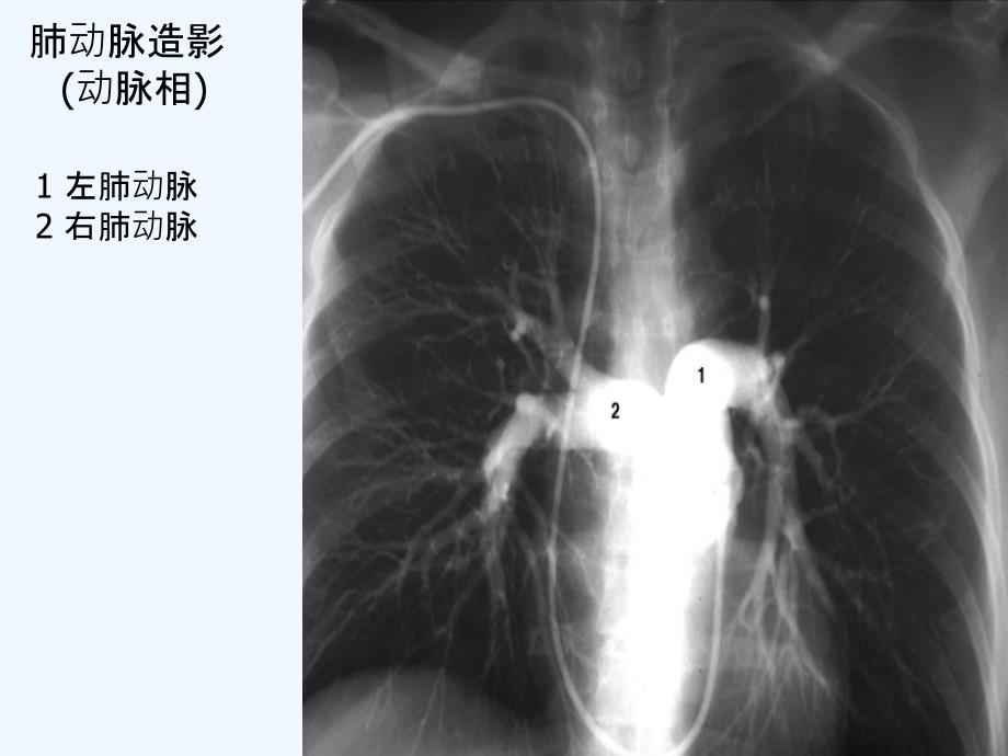 胸部x+线图解_第4页