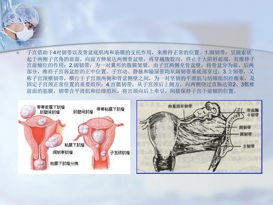 课件：腹腔镜下全子宫+双附件切除及_第4页