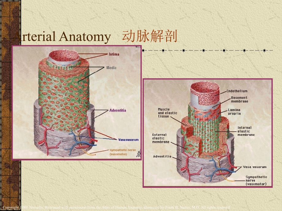 课件：腹主动脉瘤之诊断与治疗_第3页