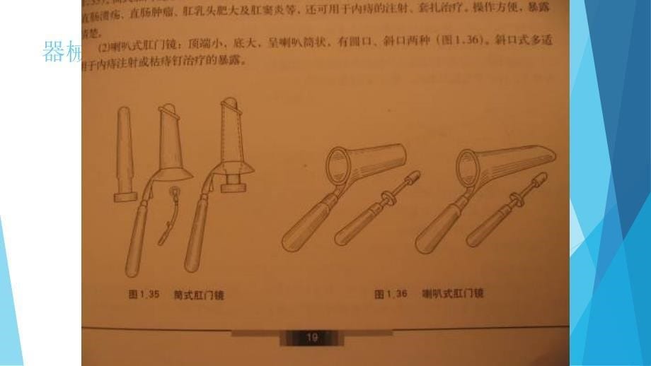 课件：结肠癌、直肠癌病人的护理_第5页