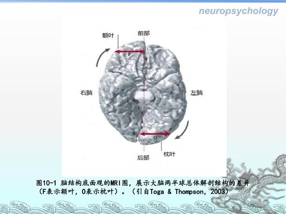 第十章 大脑功能的偏侧化_第5页