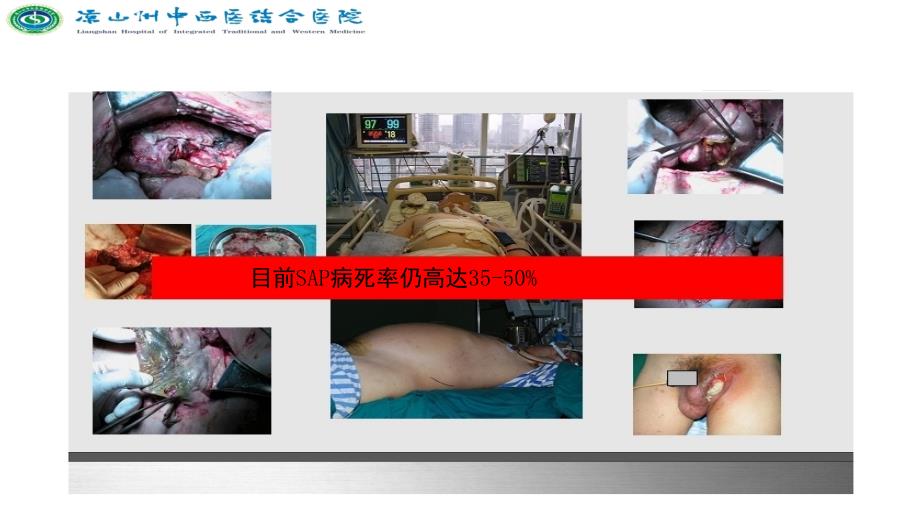 课件：急性胰腺炎_第3页