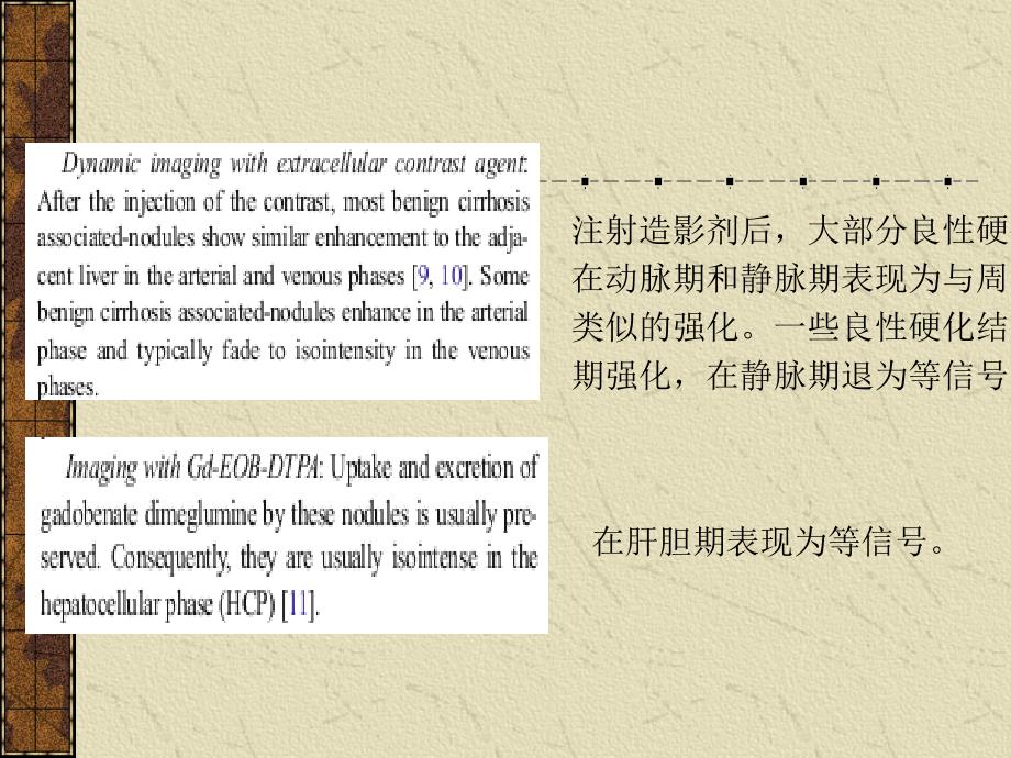 课件：肝脏特异性造影剂普美显mr应用_第4页