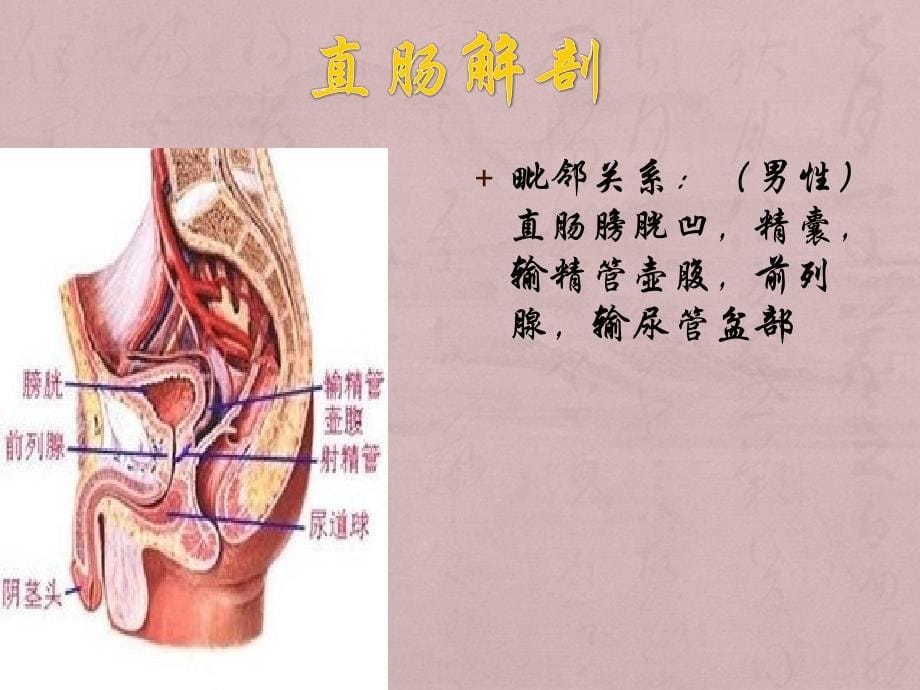 课件：腹腔镜直肠癌前切除_第5页