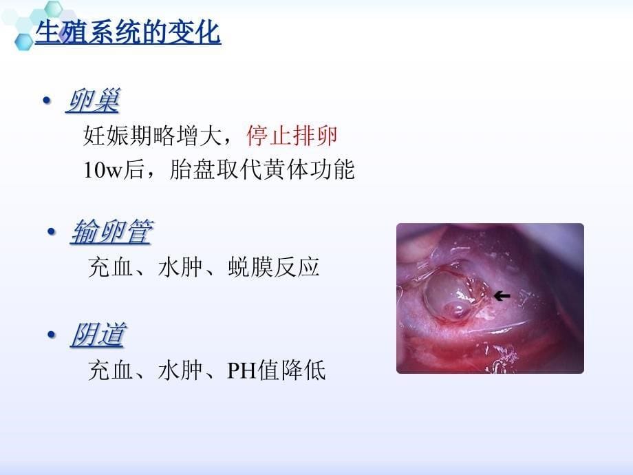 课件：妊娠期孕妇的护理_第5页