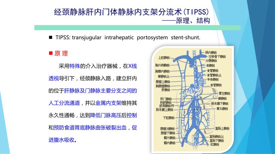 课件：经颈静脉肝内门体分流术(tips)_第3页