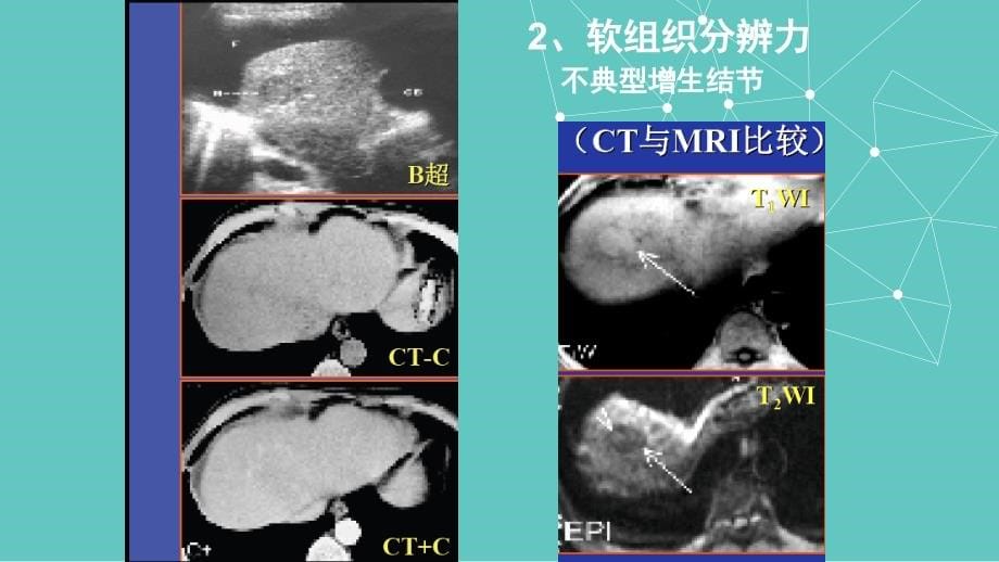 课件：腹部mri_第5页