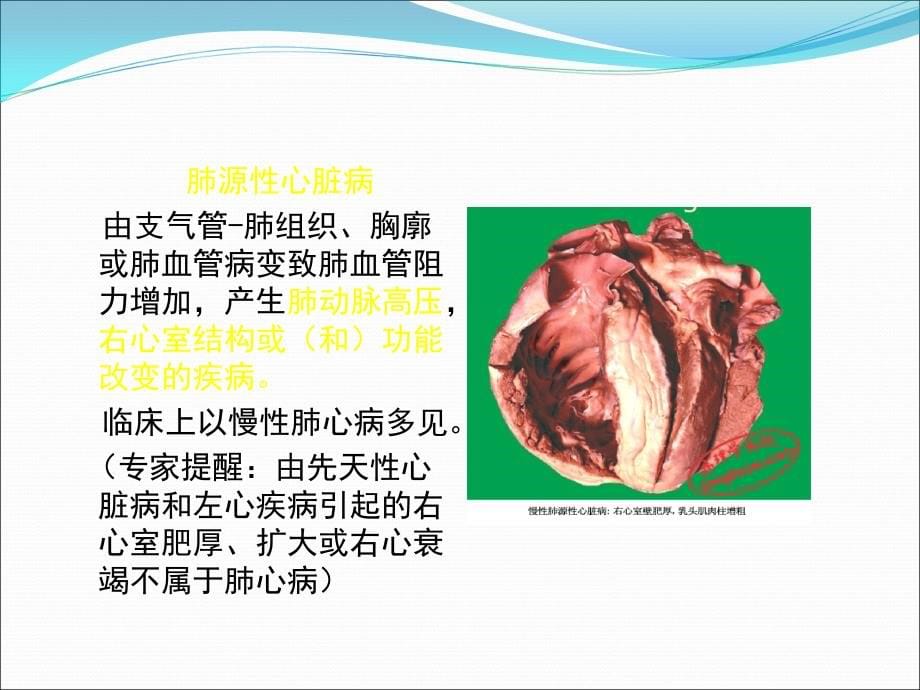 课件：肺源性心脏病_第5页