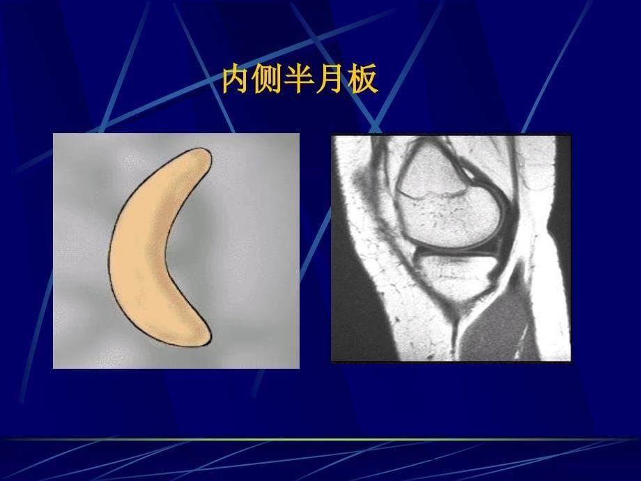 四肢关节解剖_第5页