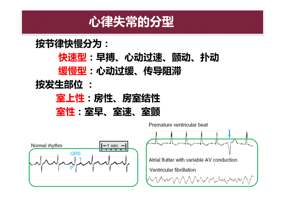 药理学 抗心律失常药物_第2页