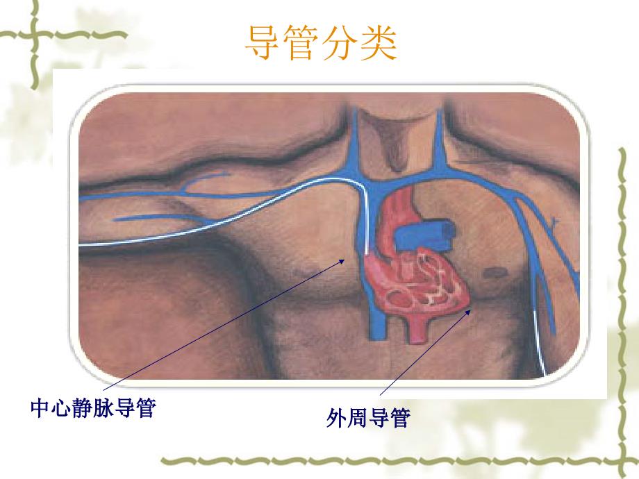 静脉输液工具选择及维护_第3页