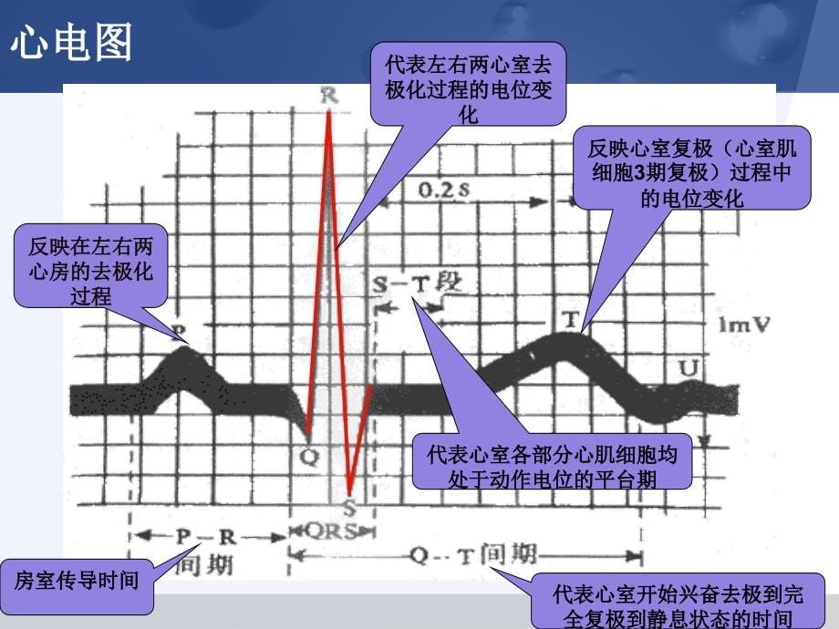 药理学：抗心律失常药_第5页