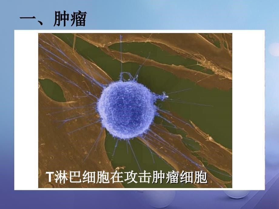 九年级科学下册 3_4 非传染性疾病课件5 （新版）浙教版_第5页