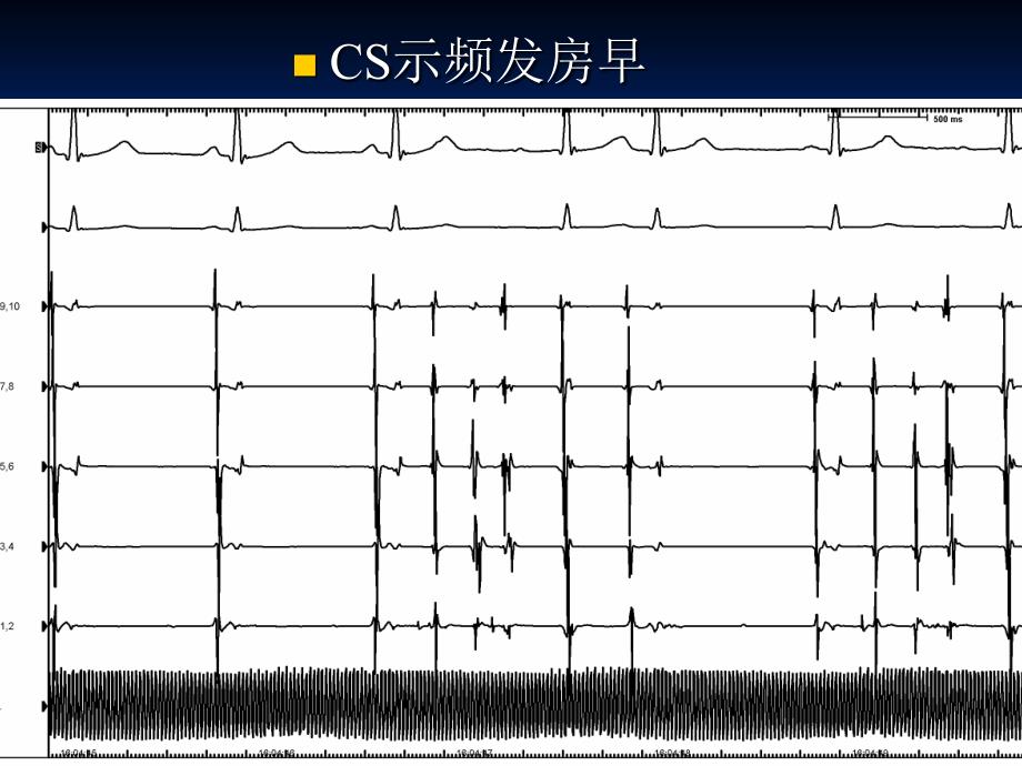 病例汇报房扑王茂敬_第4页