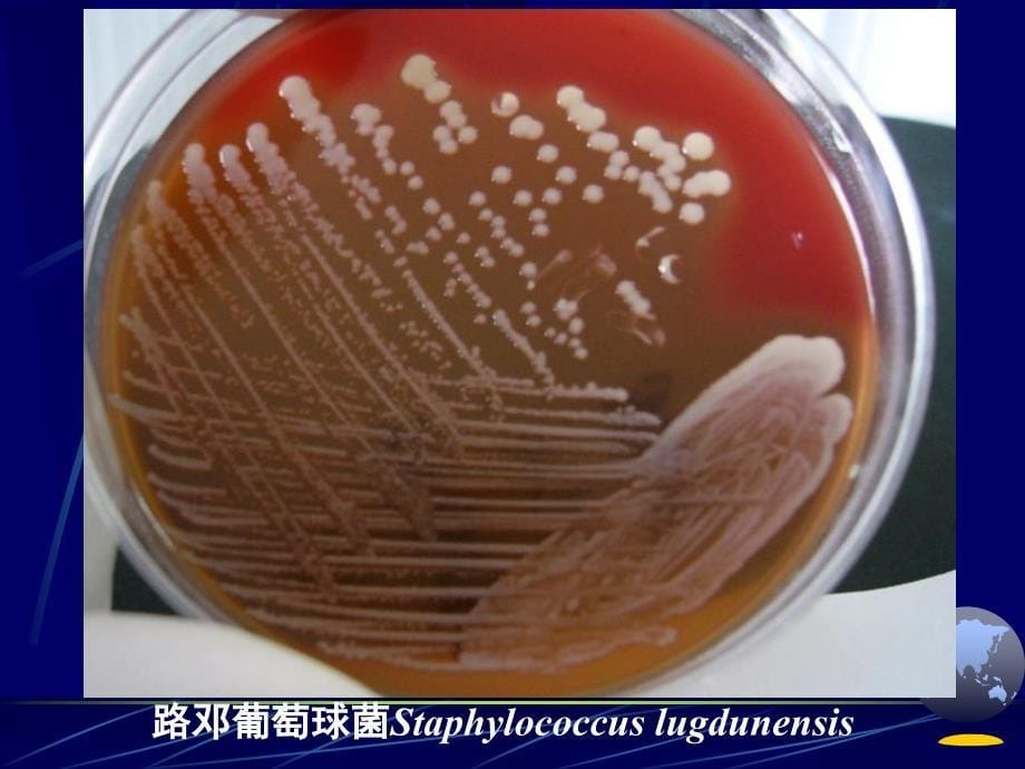 微生物菌落观察;微生物分离纯化及菌种保存_第5页