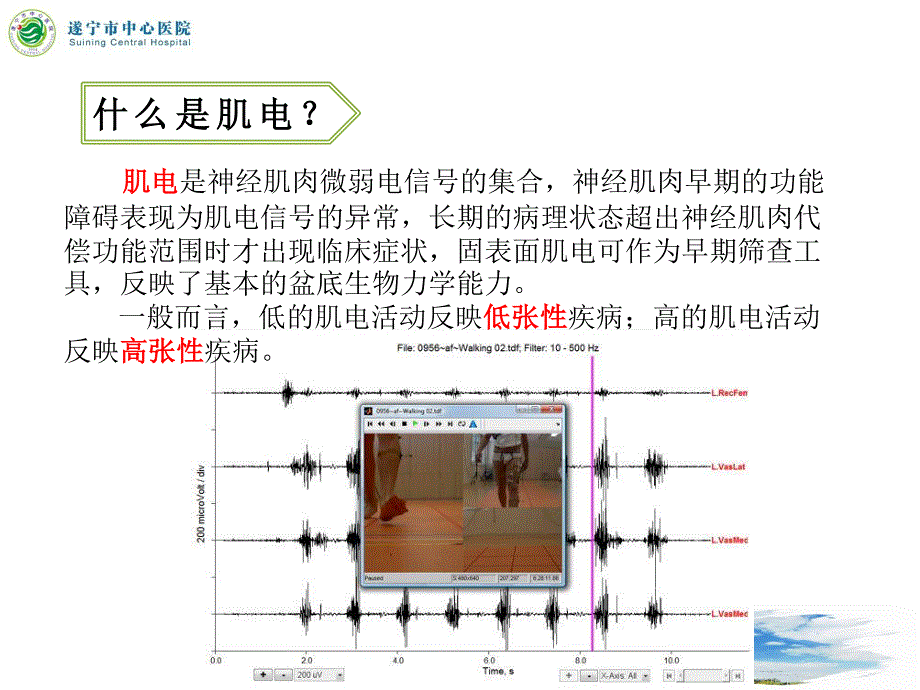 3.盆底肌电解读及应用基础_第4页