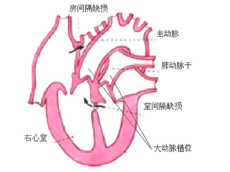 先天畸形与优生对策1_第5页