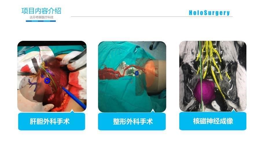 8.达芬奇眼医疗科技 (Changsha Da Vinci's Eyes Medical Technology Co.LTD) -石磊-BP20170315_第5页