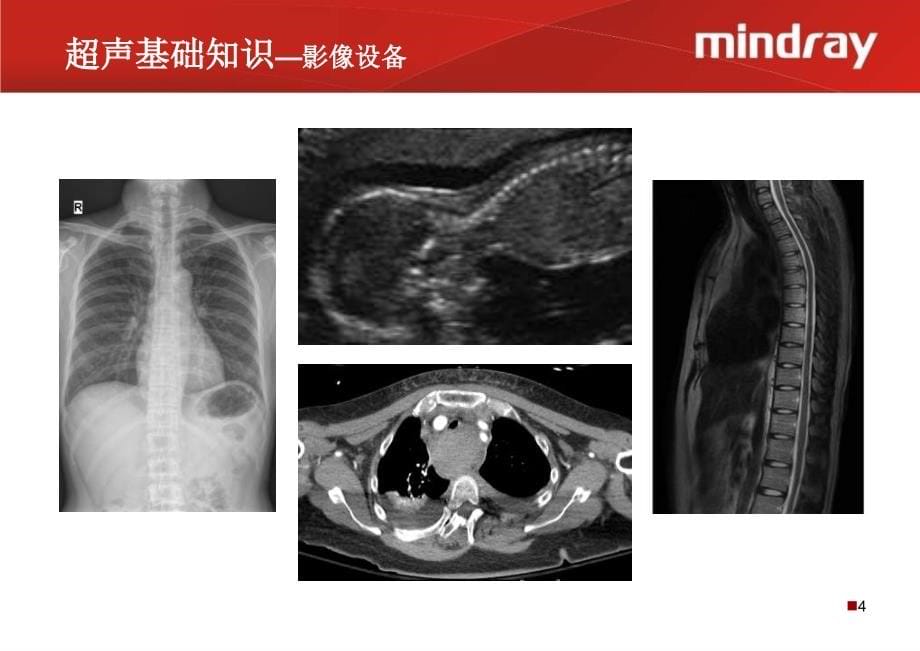 超声产品原理与临床应用知识_第5页