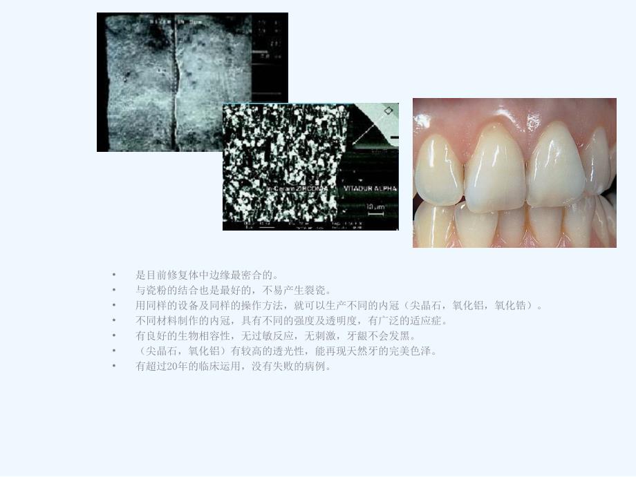 vita-玻璃渗透全瓷_第2页