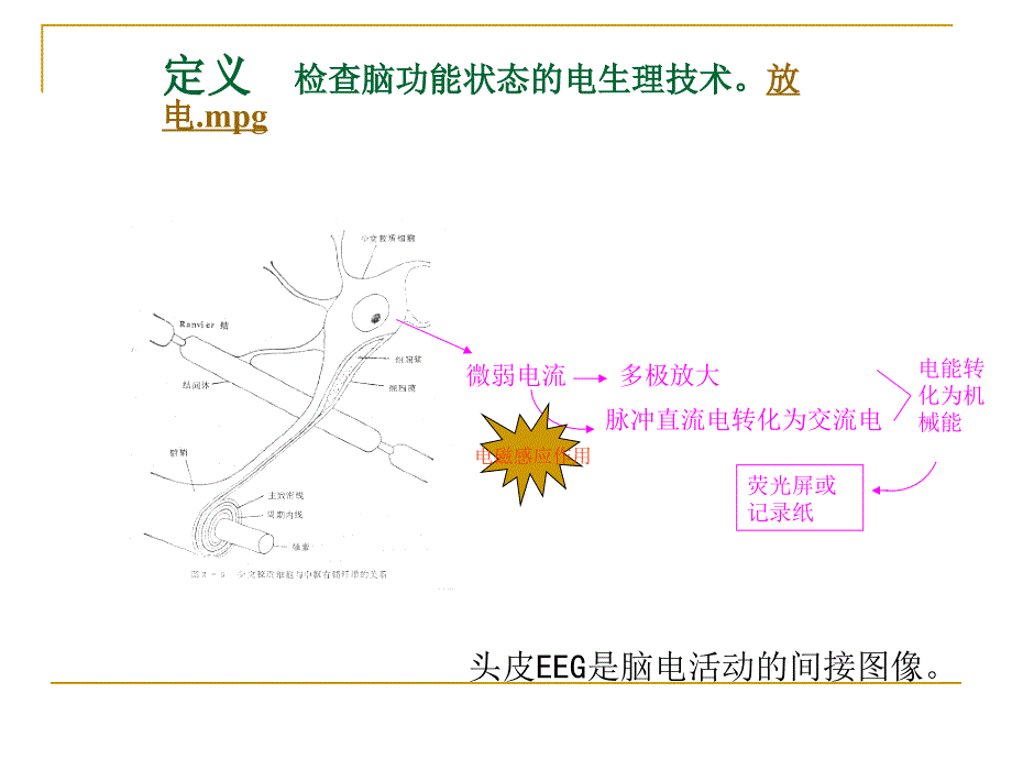 eeg基本知识与判读_第4页