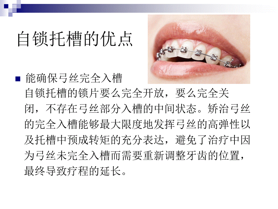 自锁托槽矫治传统托槽矫治的区别 (2)_第4页