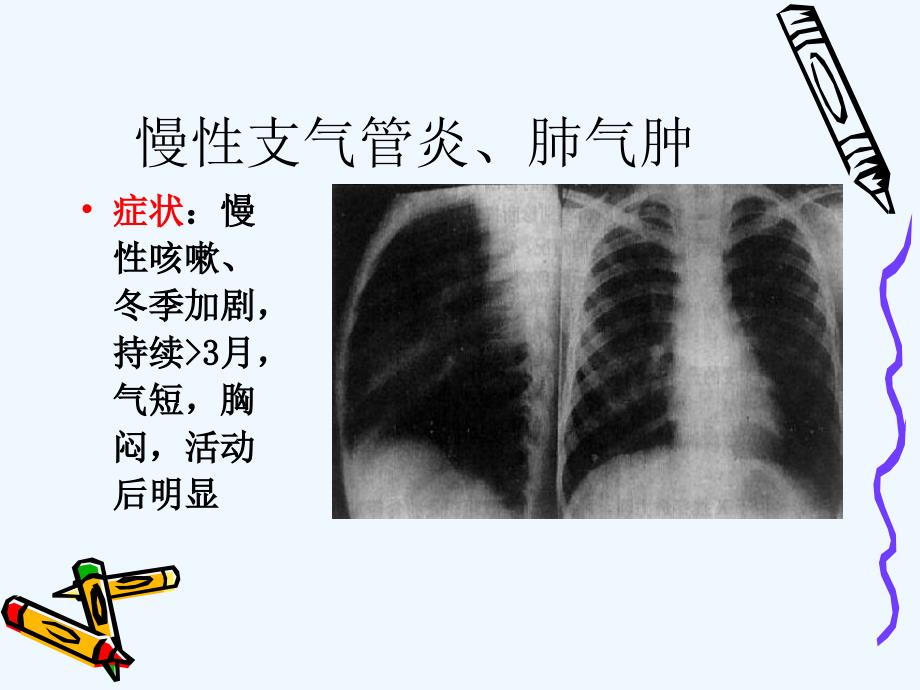 呼吸系统常见疾病症状体征_第4页