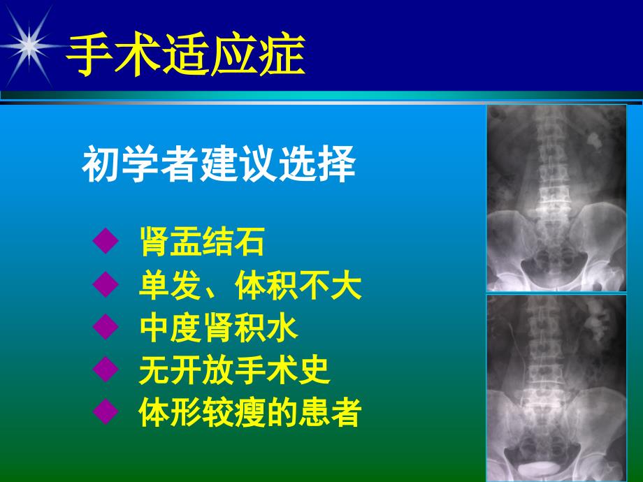 pcnl技巧与并发症预防_第2页