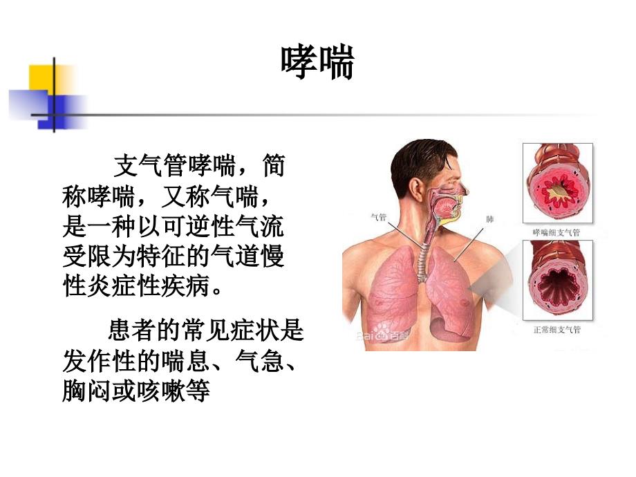 哮喘与copd不同治疗方案比较_第2页