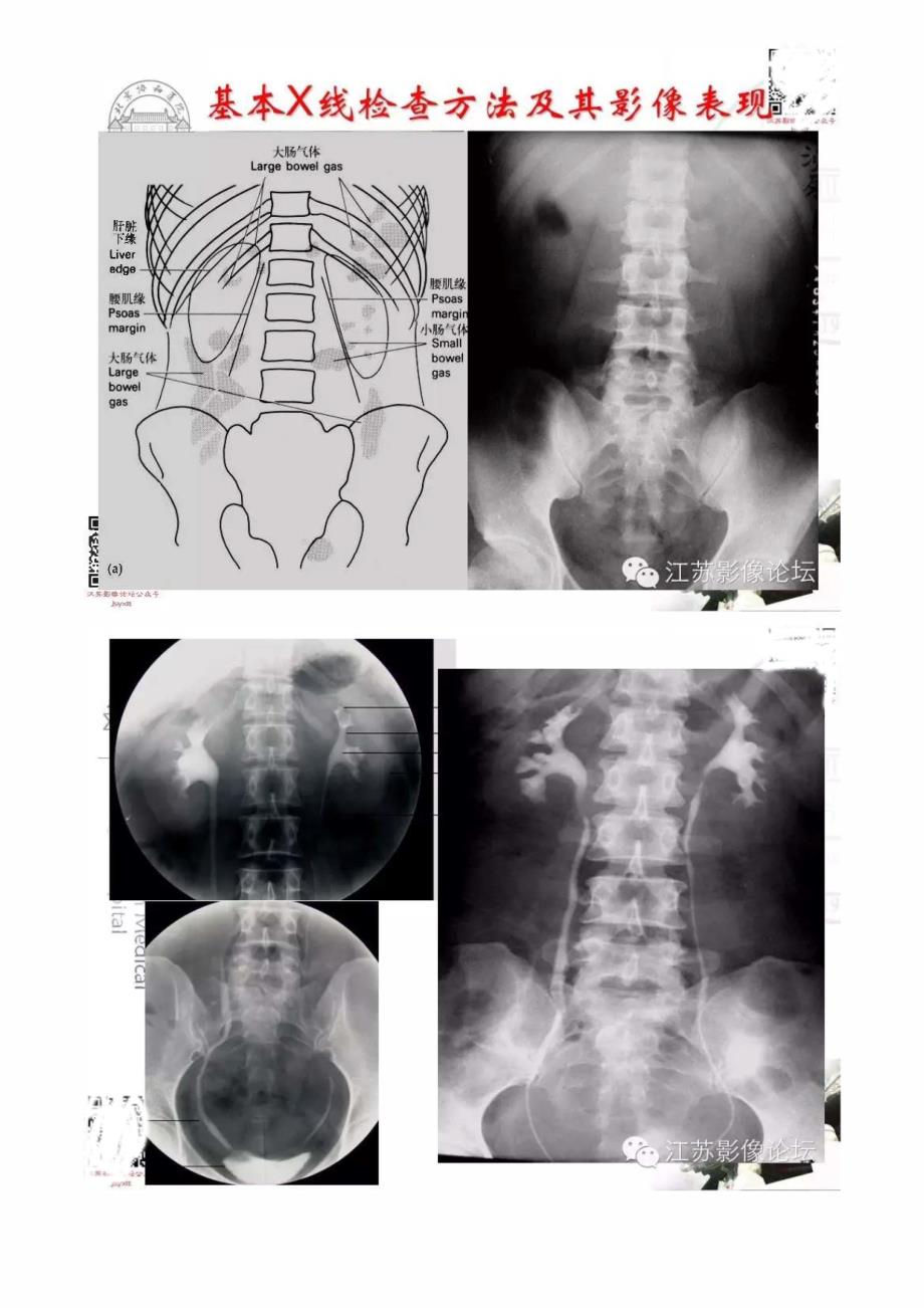 泌尿生殖系统正常与异常影像学表现_第2页