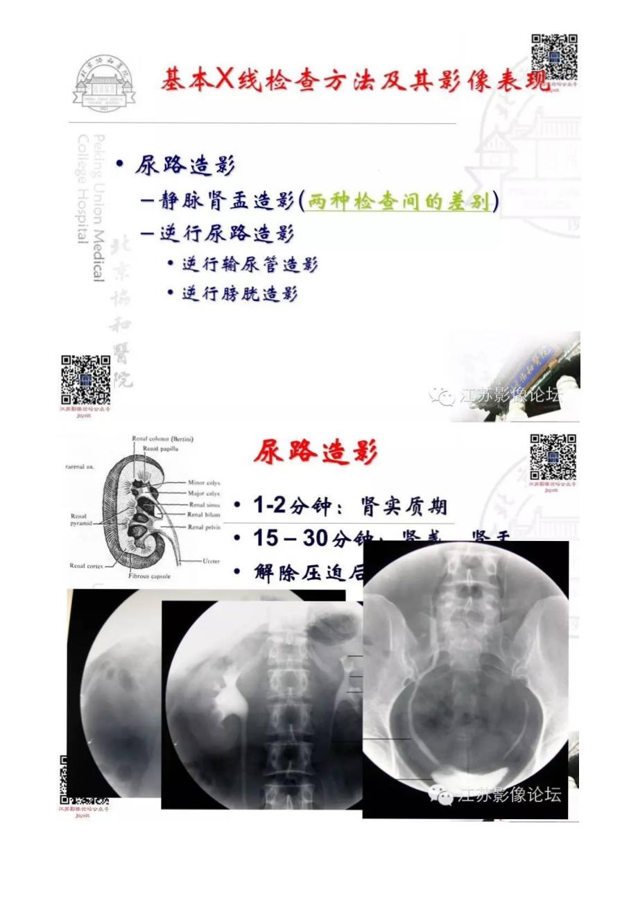 泌尿生殖系统正常与异常影像学表现_第3页