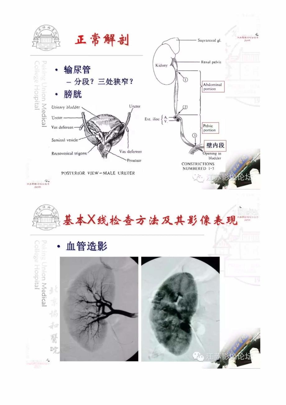 泌尿生殖系统正常与异常影像学表现_第4页