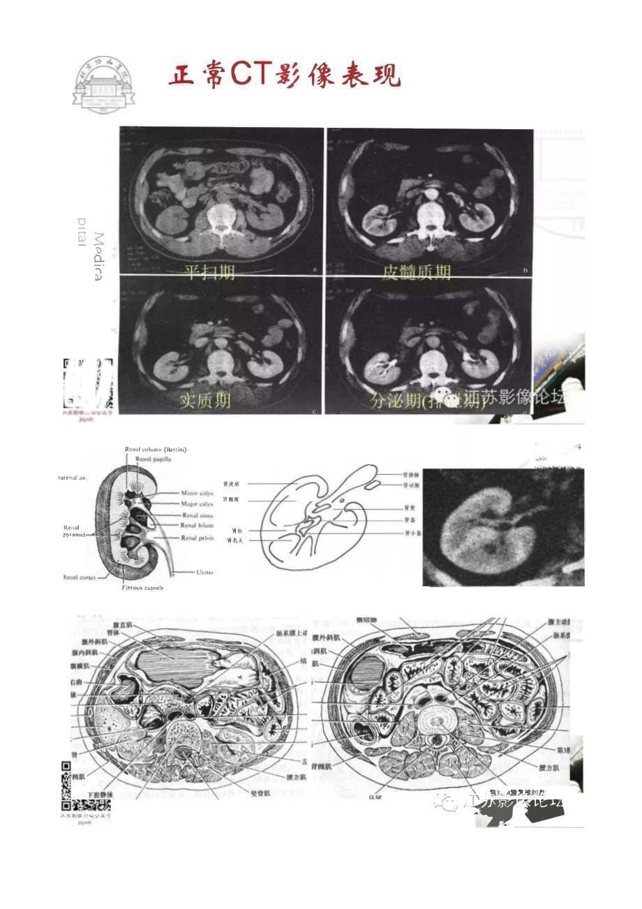 泌尿生殖系统正常与异常影像学表现_第5页