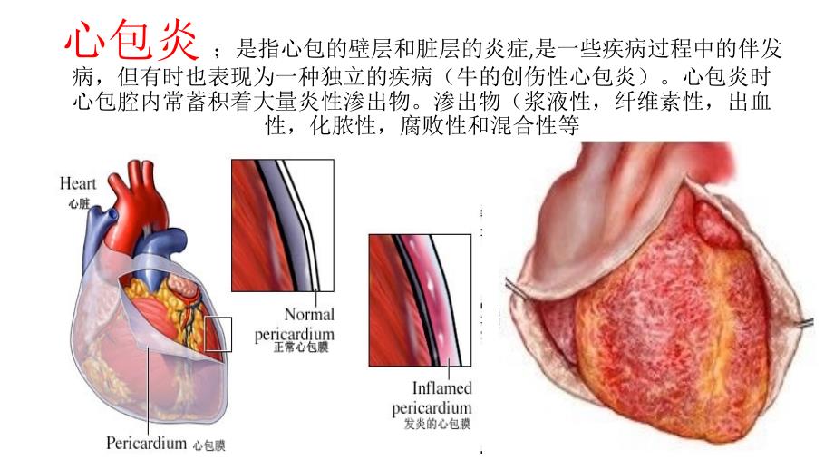 心脏与造血系统病理_第3页