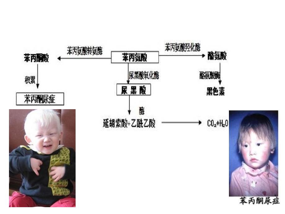 血氨基酸肉碱谱与尿有机酸谱_第4页