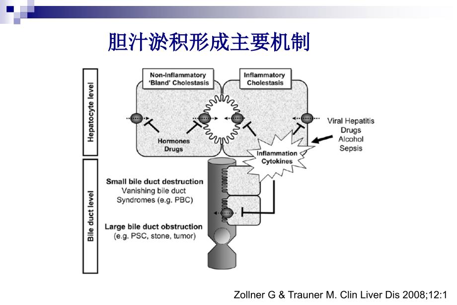 胆汁淤积发病机制与治疗选择陆伦根_第4页