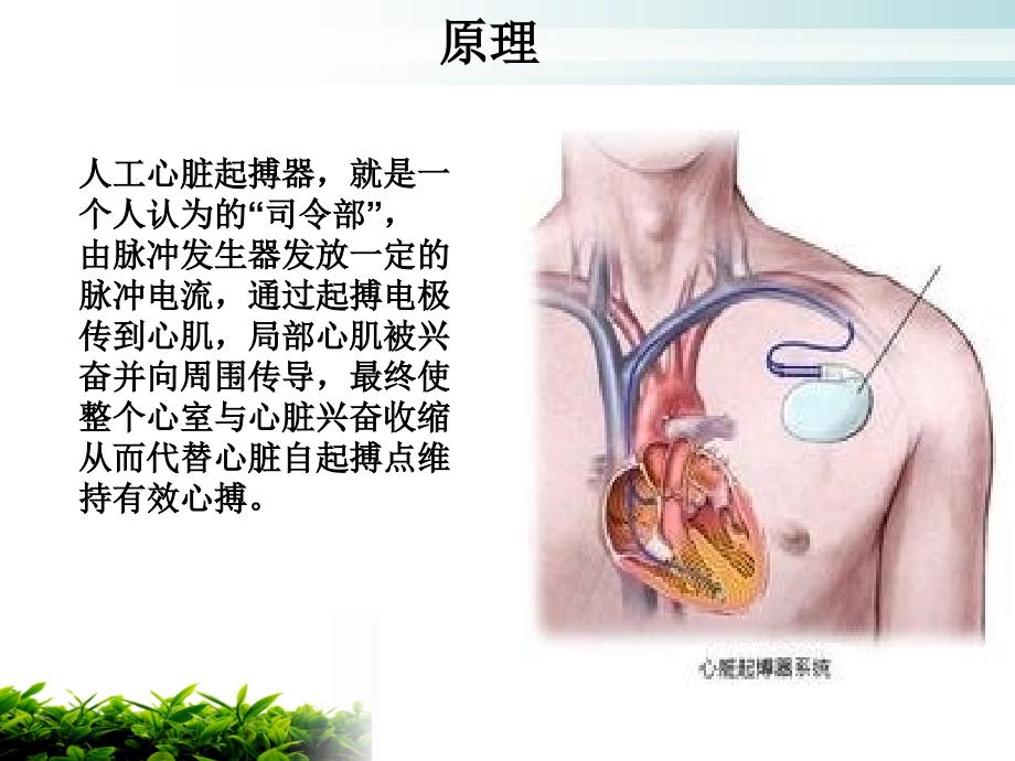 永久起搏器植入病人护理与相关注意事项_第3页