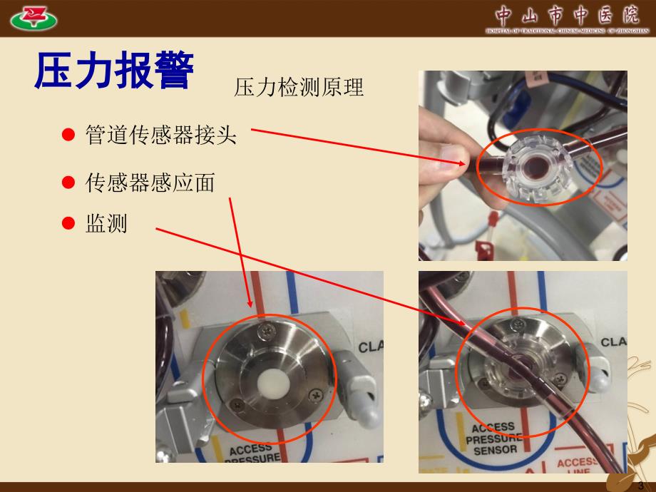 血液净化常见报警及处理_第3页