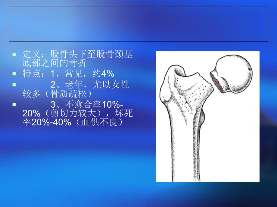 股骨颈骨折42312_第3页