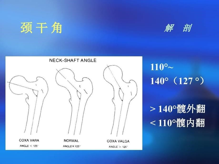 股骨颈骨折42312_第5页