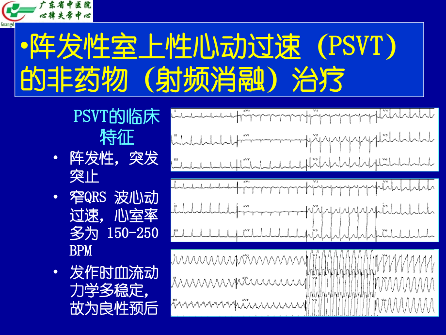 心律失常非药物治疗丁春华_第4页