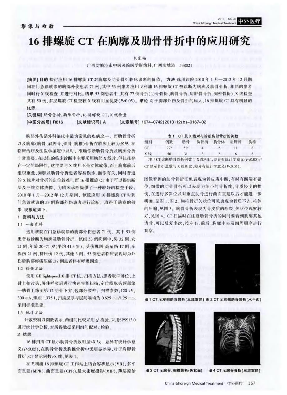 16排螺旋CT 在胸廓及肋骨骨折中的应用研究_第1页